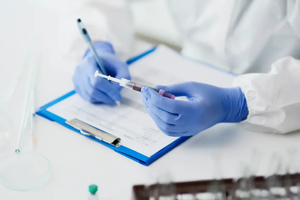 Analysis of test tube with a sample 2023 11 27 05 03 25 utc